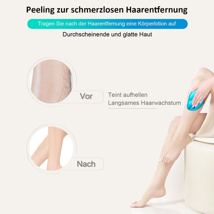 Rubby Schmerzlose Haarentfernung Kristall Epilierer für Körper Arm Beine Nano
